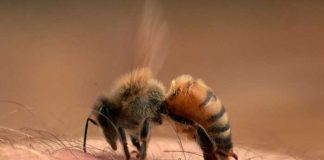 Foto: Picaduras de abejas