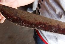 Atacado por su propio machete: Se vengan de «tomador violento» en Kukra Hill Foto: Machete con sangre / imagen referencial