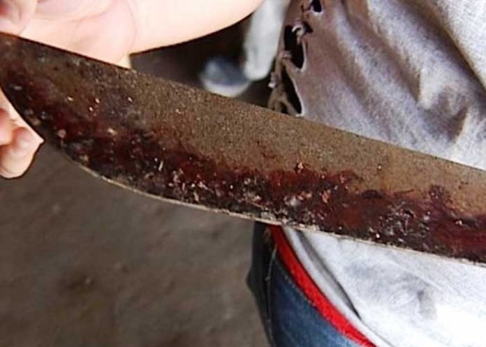 mach-san-1 Foto: Machete con sangre / imagen referencial