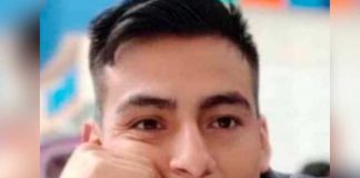 En Perú hombre le desfiguró el rostro a su novia por no responderle las llamadas