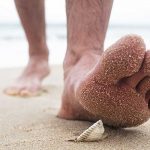 ¡Por andar descalza en la playa! Joven contrae extraña infección por parásito ¡Por andar descalza! Joven contrae extraña infección por parásitos