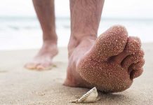 ¡Por andar descalza en la playa! Joven contrae extraña infección por parásito ¡Por andar descalza! Joven contrae extraña infección por parásitos