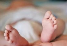 ¡Insólito! Nace un bebé con cola «humana» en Guyana ¡Insólito! Nace un bebé con cola "humana" en Guayana