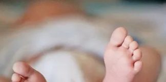 ¡Insólito! Nace un bebé con cola "humana" en Guayana