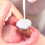 «OJO» Peligrosa enfermedad bucal capaz de dañar los huesos y romper los dientes Esta es la peligrosa enfermedad bucal