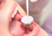 «OJO» Peligrosa enfermedad bucal capaz de dañar los huesos y romper los dientes Esta es la peligrosa enfermedad bucal