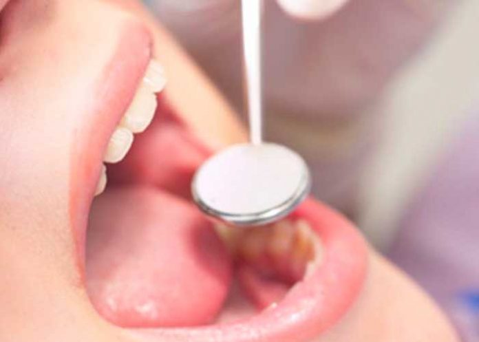 Esta es la peligrosa enfermedad bucal 