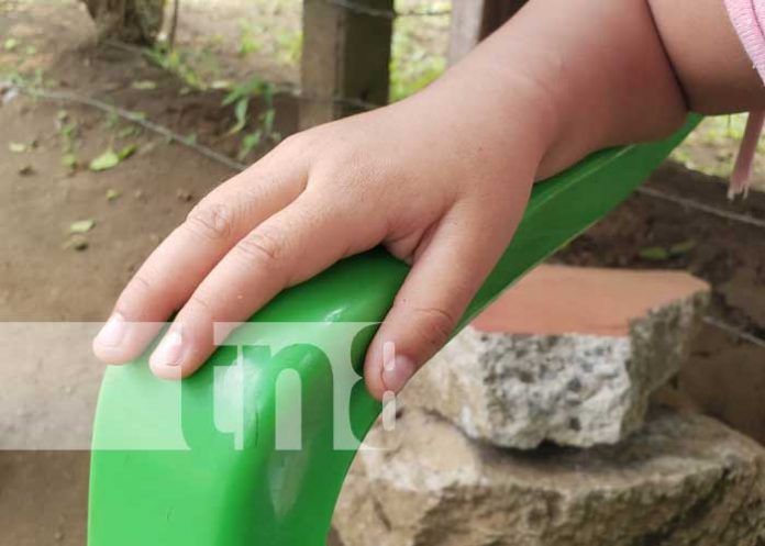 quema-1 Foto: Niño sufre quemadoras con agua hirviendo en Masaya / TN8