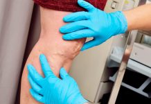 Puedes estar sufriendo de una trombosis profunda y no lo sabés Puedes estar sufriendo de una trombosis profunda y no lo sabés