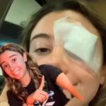 Una joven termina en el hospital por truco de belleza que vio en TikTok Una joven termina en el hospital por truco de belleza que vio en TikTok