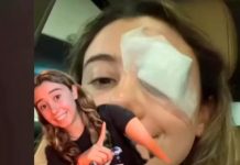 Una joven termina en el hospital por truco de belleza que vio en TikTok Una joven termina en el hospital por truco de belleza que vio en TikTok