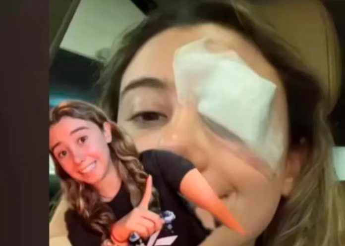 1 Una joven termina en el hospital por truco de belleza que vio en TikTok