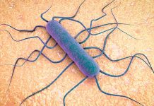 En Estados Unidos el brote de una bacteria deja varios muertos En Estados Unidos el brote de una bacteria deja varios muertos