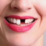 Crean medicamento que permitirá que los dientes vuelvan a crecer