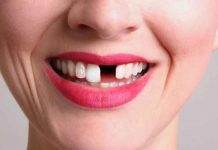 Crean medicamento que permitirá que los dientes vuelvan a crecer