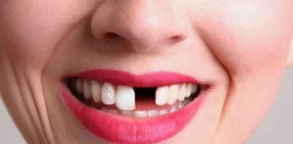 Crean medicamento que permitirá que los dientes vuelvan a crecer