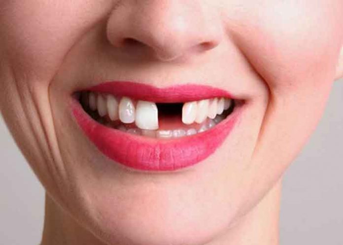 3 Crean medicamento que permitirá que los dientes vuelvan a crecer