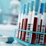 Reportan alarmante aumento de sífilis en Houston, Estados Unidos Reportan alarmante aumento de sífilis en Houston, Estados Unidos