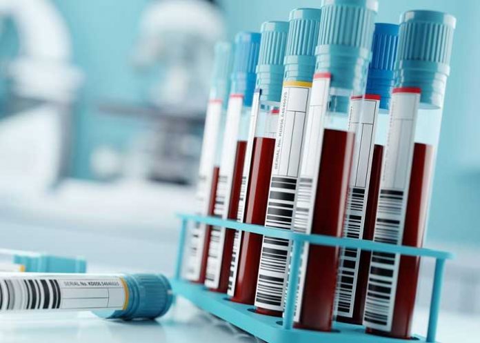 Reportan alarmante aumento de sífilis en Houston, Estados Unidos