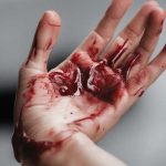 Murió en agonía tras ser atropellada: Autor se dio a la fuga en El Rama Foto: Mano ensangrentada (IA)