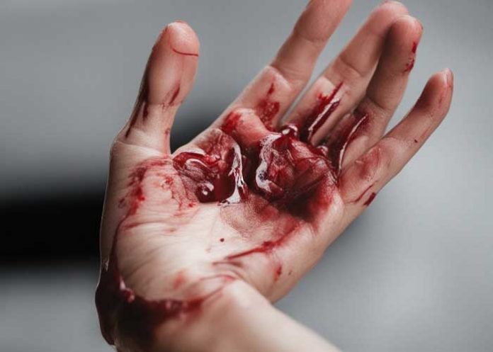 Foto: Mano ensangrentada (IA)