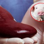 «¡Rompiendo barreras! Riñón de cerdo salva vida humana en trasplante histórico.» "¡Rompiendo barreras! Riñón de cerdo salva vida humana en trasplante histórico."