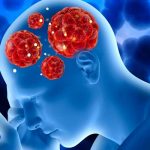 Muere tras infectarse con una ameba comecerebros