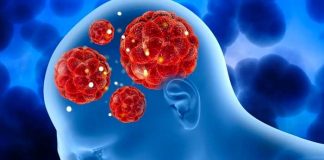 Muere tras infectarse con una ameba comecerebros