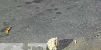 Foto: Mujer le raja la cabeza a su "marido" y huye del lugar en bar de Managua / TN8