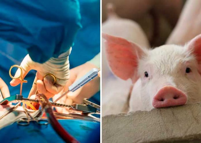 Foto: Trasplante de corazón de Cerdo en EE.UU. /cortesía