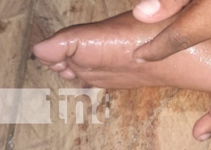 Foto: Rayo alcanza a un niño en Waspán, Caribe Norte de Nicaragua / TN8