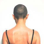 Le rapó la cabeza por burlarse de joven con cáncer