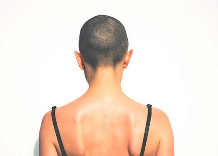 Le rapó la cabeza por burlarse de joven con cáncer