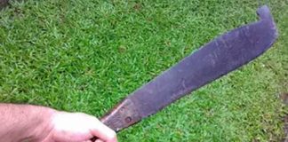 Foto: Violento ataque a machetazos deja cinco lesionados en Jinotega / TN8