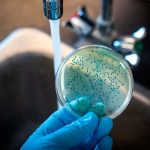 «Chiva» se desatan bacterias carnívoras en Estados Unidos Foto: Bacterias en EE.UU. /cortesía