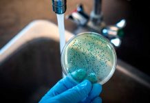 «Chiva» se desatan bacterias carnívoras en Estados Unidos Foto: Bacterias en EE.UU. /cortesía