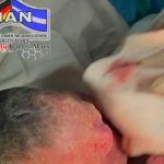 Trillizas nacen y conquistan las redes sociales en Nicaragua Trillizas nacen y conquistan las redes sociales en Nicaragua