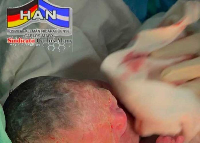 Trillizas nacen y conquistan las redes sociales en Nicaragua