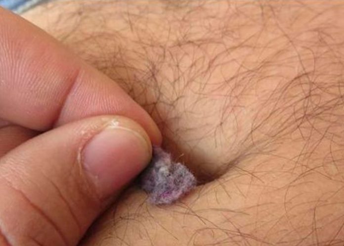 Revelan el impacto sorprendente de microbios en la piel