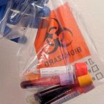 ¿Es necesario estar en ayuna para un examen de sangre? Aquí los detalles Foto: ayuno ante pruebas de sangre /cortesía