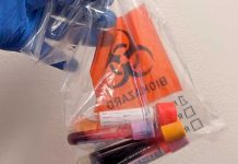 ¿Es necesario estar en ayuna para un examen de sangre? Aquí los detalles Foto: ayuno ante pruebas de sangre /cortesía