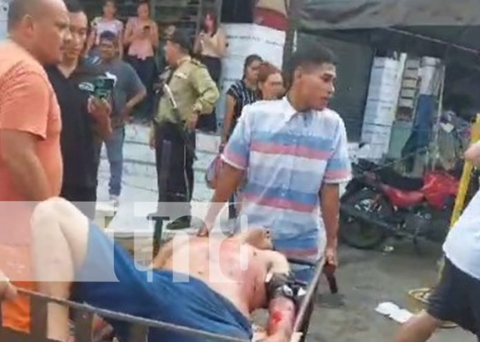 2 Foto: Hombre es agredido a machetazos /TN8