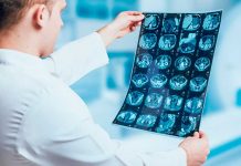 ¿Notas cambios en tu orina? Podría ser una señal de cáncer de próstata Foto: Síntomas y riesgos del cáncer de próstata /cortesía