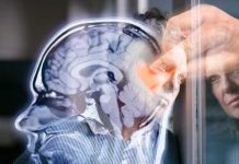 ¿Es tu tipo de sangre un factor clave en tu salud cerebral? Foto: ¿Es tu tipo de sangre un factor clave en tu salud cerebral? /cortesía