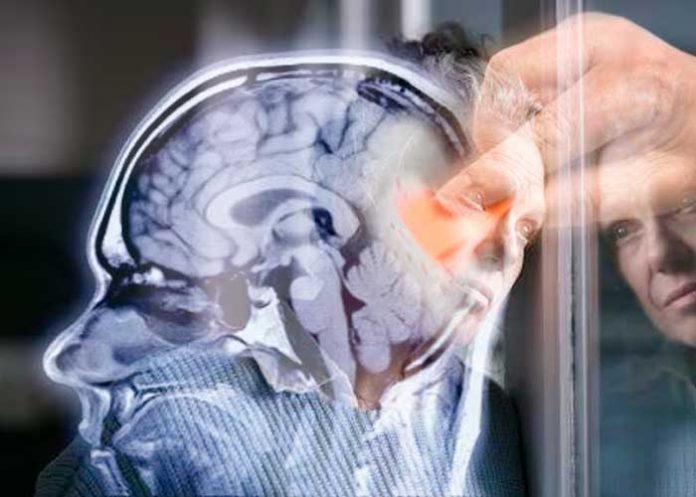 4 Foto: ¿Es tu tipo de sangre un factor clave en tu salud cerebral? /cortesía