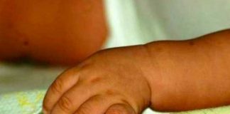 Bebé de un año fue brutalmente golpeado en Bolivia
