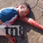 Se cortó la yugular luego de creer haber matado a su cónyuge en Corn Island Foto: Confrontación conyugal lleva a un desenlace fatal en Corn Island /TN8