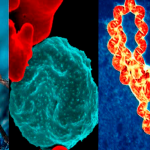 Se confirman menos contagios de Dengue, Neumonía, Malaria y Leptospirosis Foto: Se confirman menos contagios de Dengue, Neumonía, Malaria y Leptospirosis /Cortesía