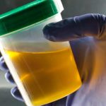 ¿Por qué es amarilla la orina? Científicos de EE.UU lo explican Foto: Revelan misterio del color de la orina /cortesía