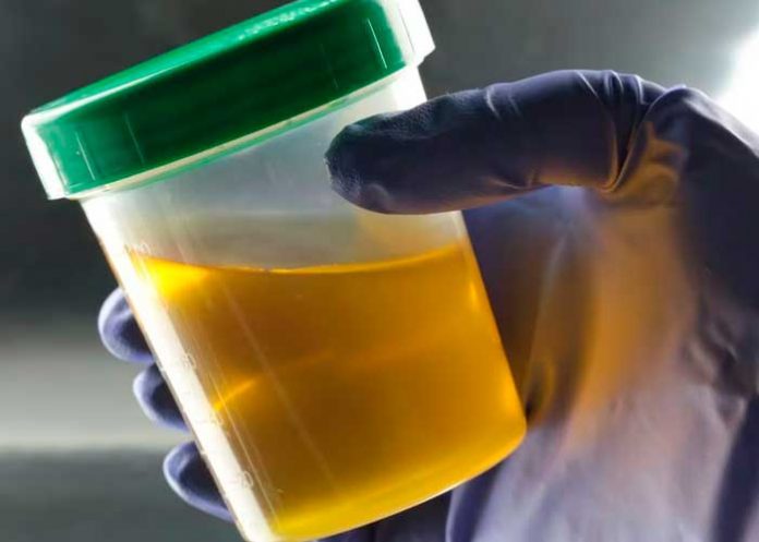 Foto: Revelan misterio del color de la orina /cortesía